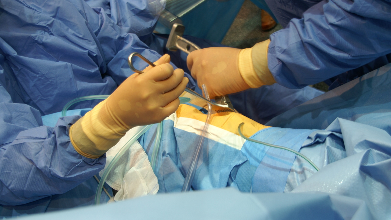 В Подмосковье пенсионерке удалили опухоль весом три килограмма - Мослента