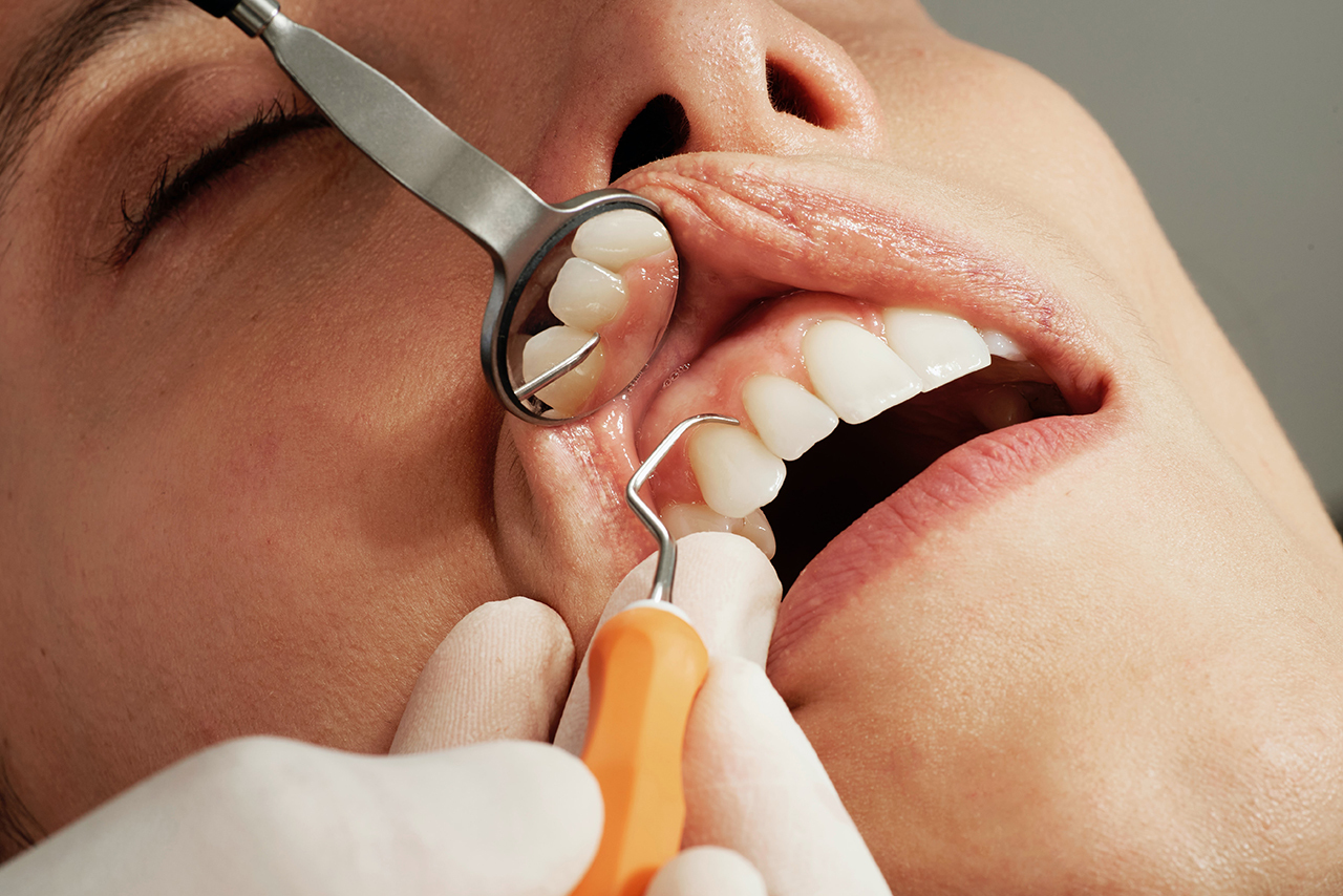 Перечислены требующие срочного обращения к стоматологу признаки