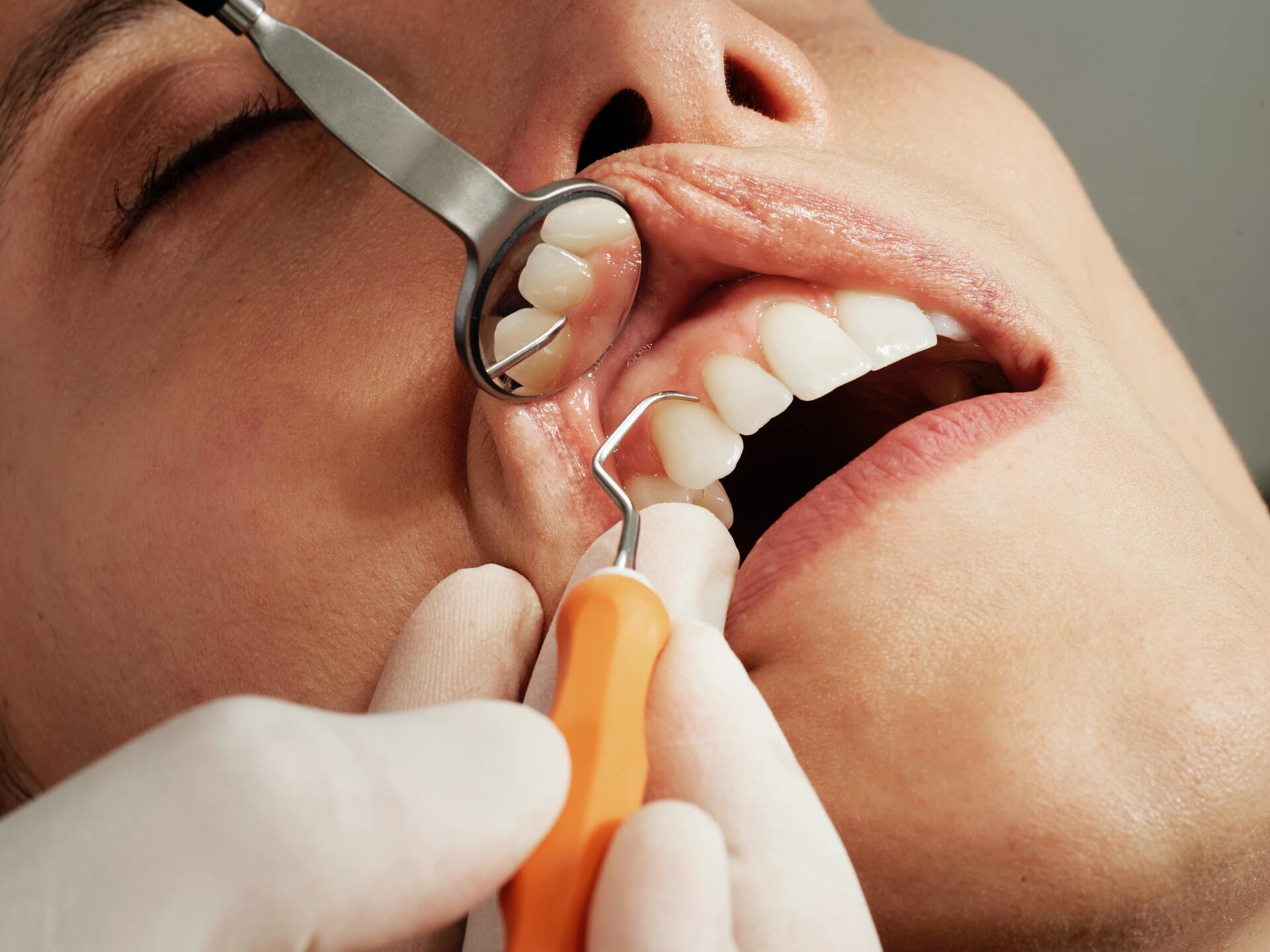 Стоматолог назвала основные продукты для сохранения здоровья зубов
