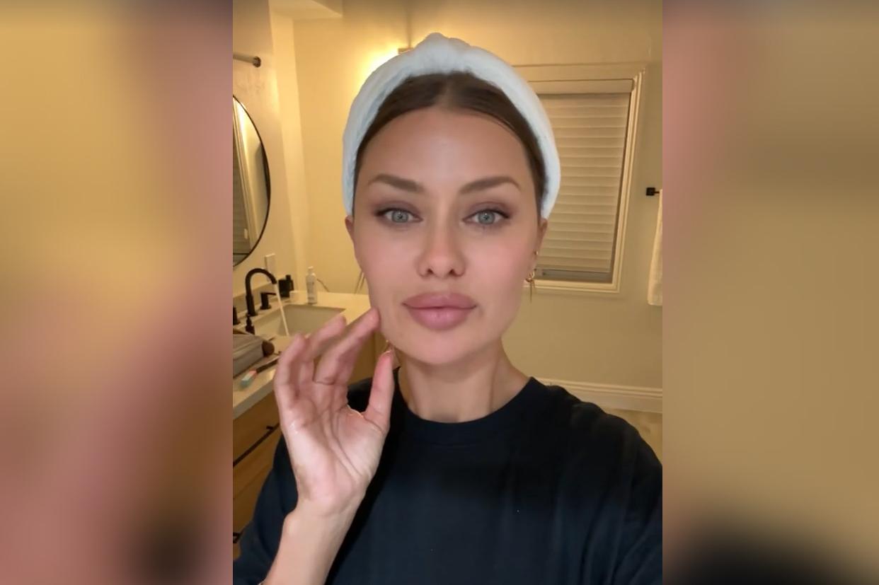 Виктория Боня сделала инъекции в лицо и записала результат на видео