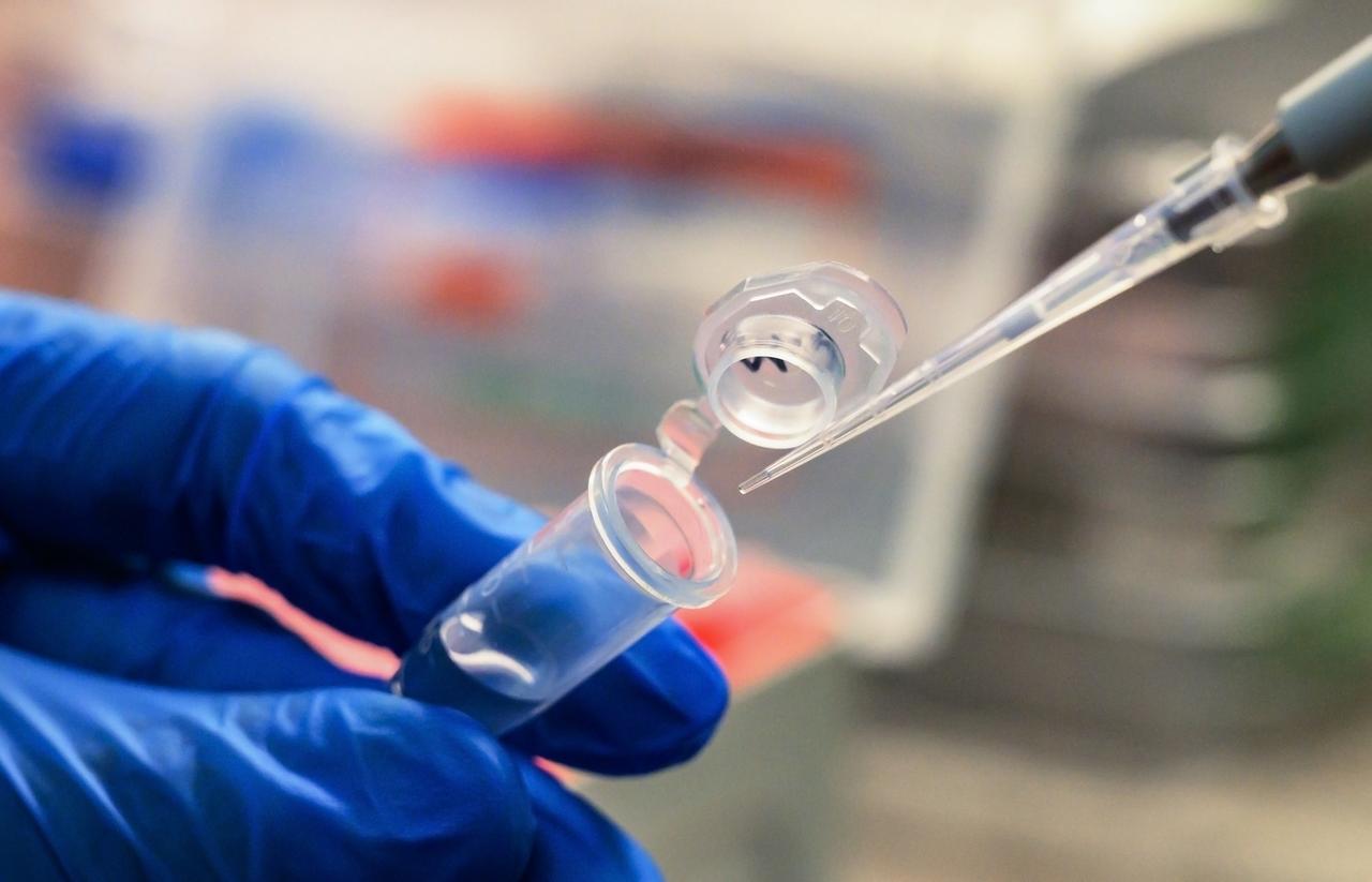 У москвичей перестали брать повторный ПЦР-тест на COVID-19 после выздоровления