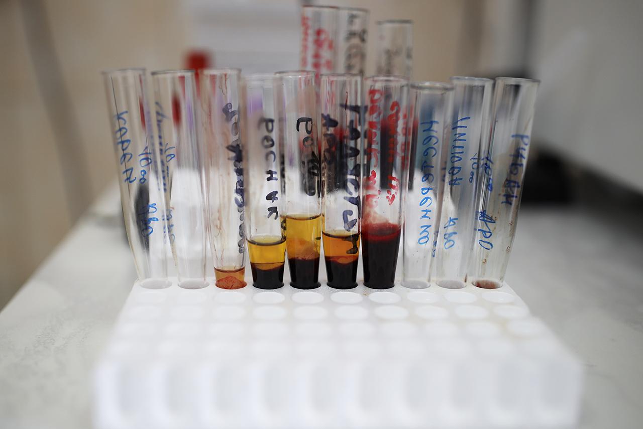 Вирусолог оценил опасность подвида омикрон-штамма «кентавр»