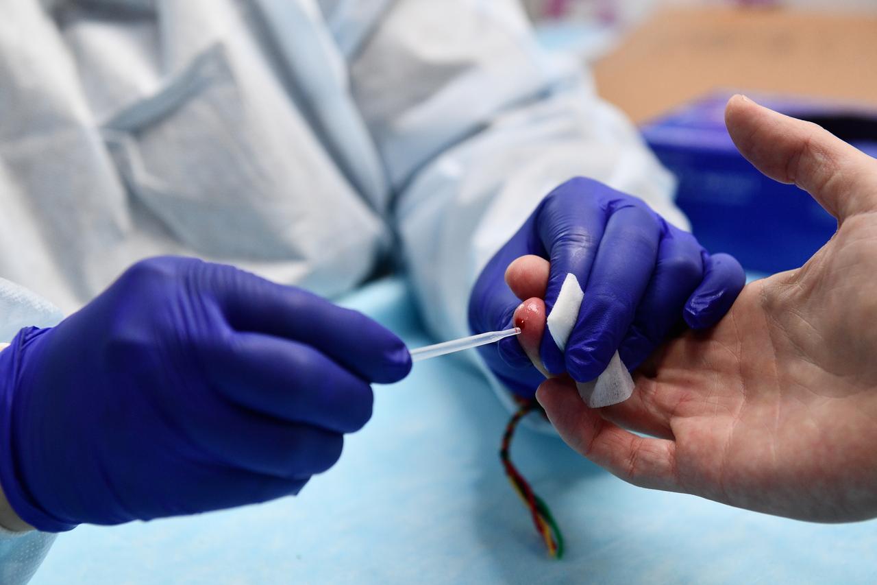 Россиянам назвали необычные источники заражения столбняком