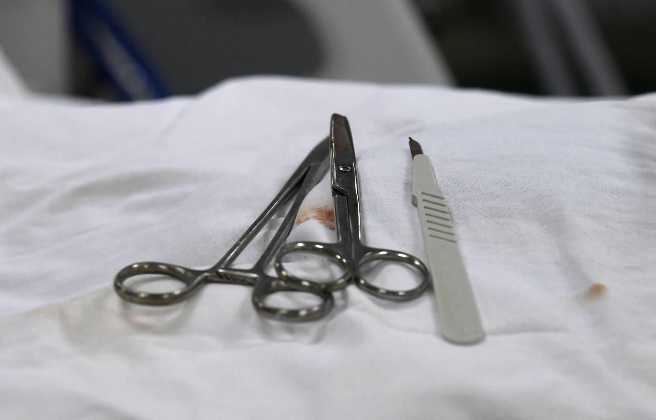 Житель Подмосковья ходил с иглой в бедре и не подозревал об этом