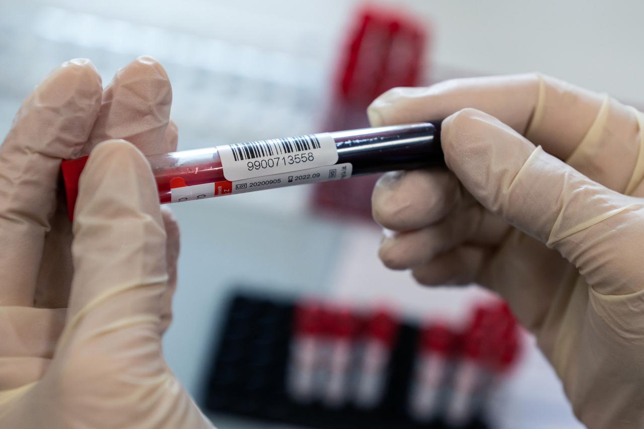 Перечислены главные опасности артериальных бляшек