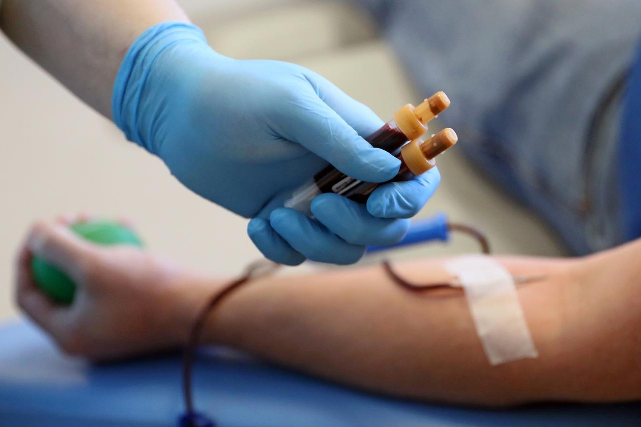 Раскрыта судьба жительницы Подмосковья после укуса гремучей змеи