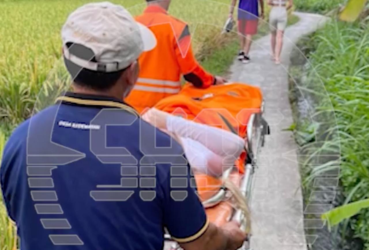 Москвичка сломала ногу за границей и получила счет на 1,5 миллиона рублей