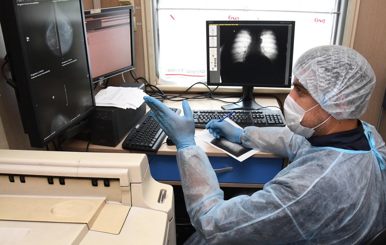 Подмосковный врач перечислила неочевидные признаки рака легких