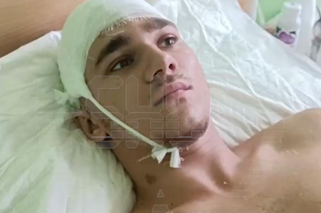 Скальпированный житель Подмосковья поделился эмоциями после случившегося