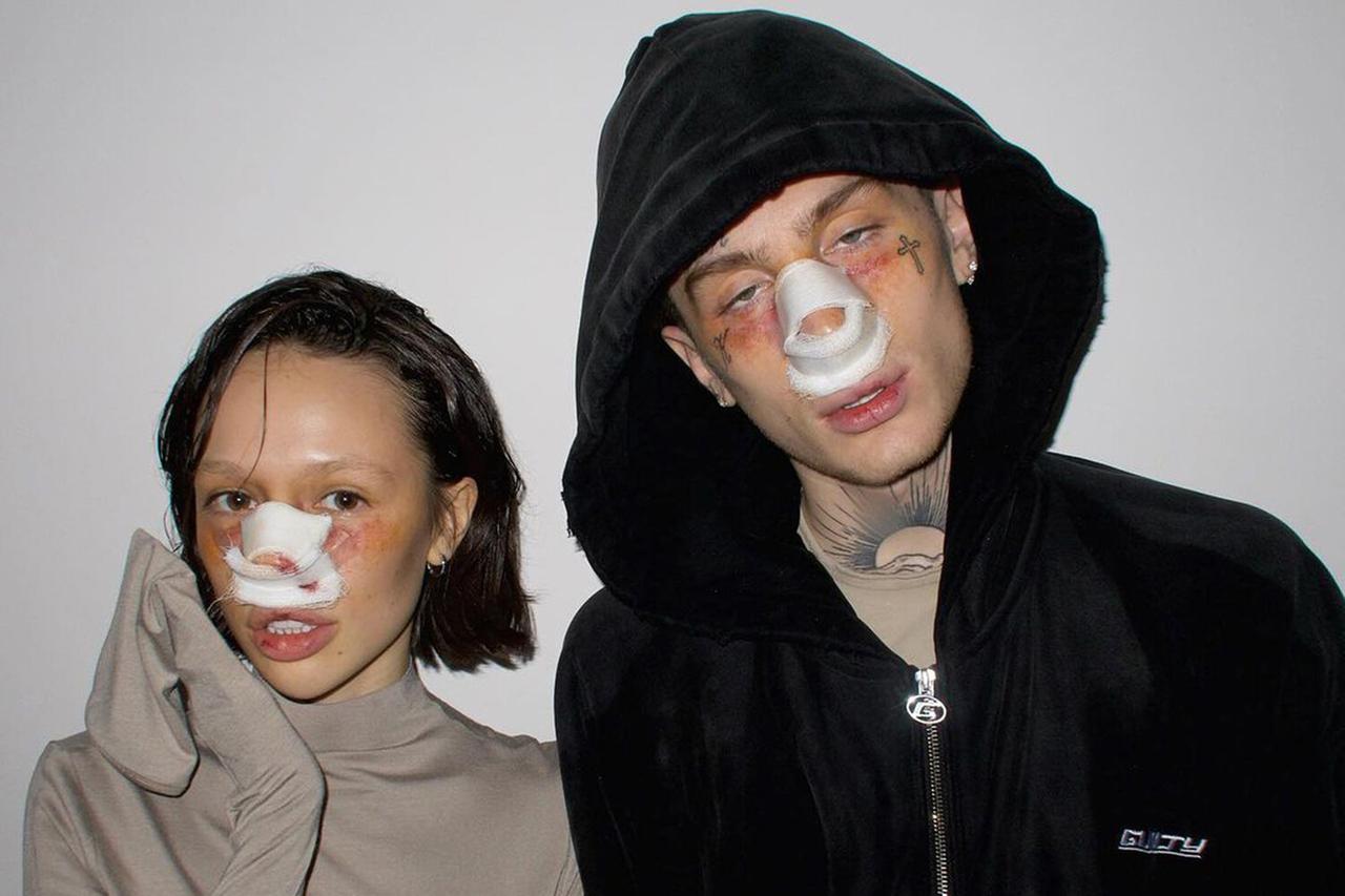 Инстасамка показала лицо после пластической операции