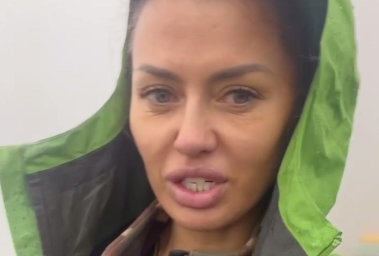 Боня показала лицо до и после пластики