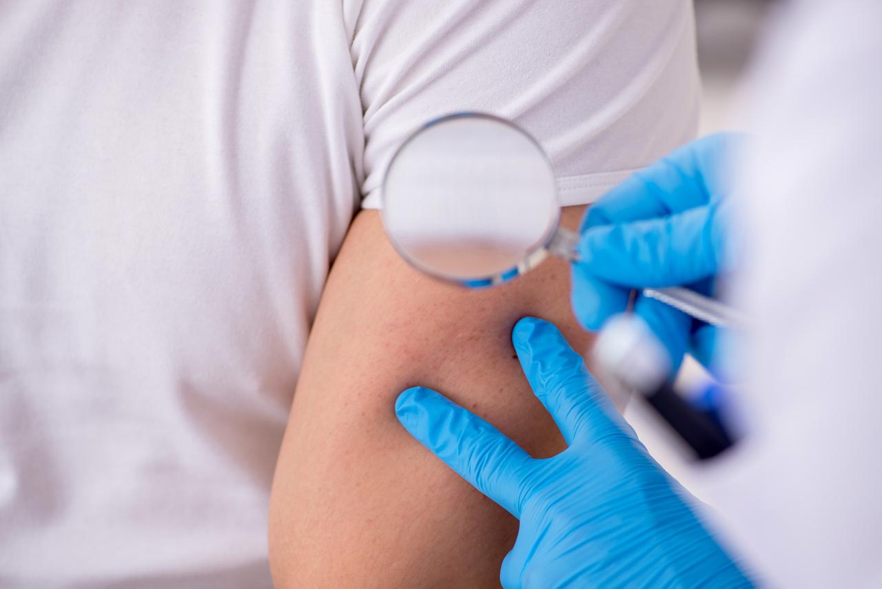 Доктор Мясников напомнил о риске развития рака в атипичных родинках