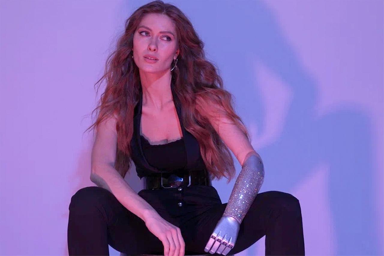 «В школе всех девчонок дергали за косички, а меня — за протез». Как родившаяся без руки москвичка стала кибермоделью