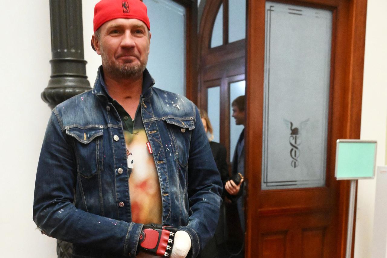 Костомаров рассказал о реакции его детей на протезы