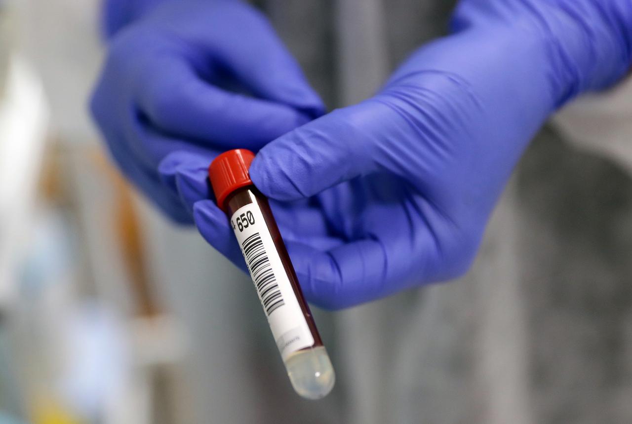 Доктор Мясников развеял популярный миф о профилактике деменции