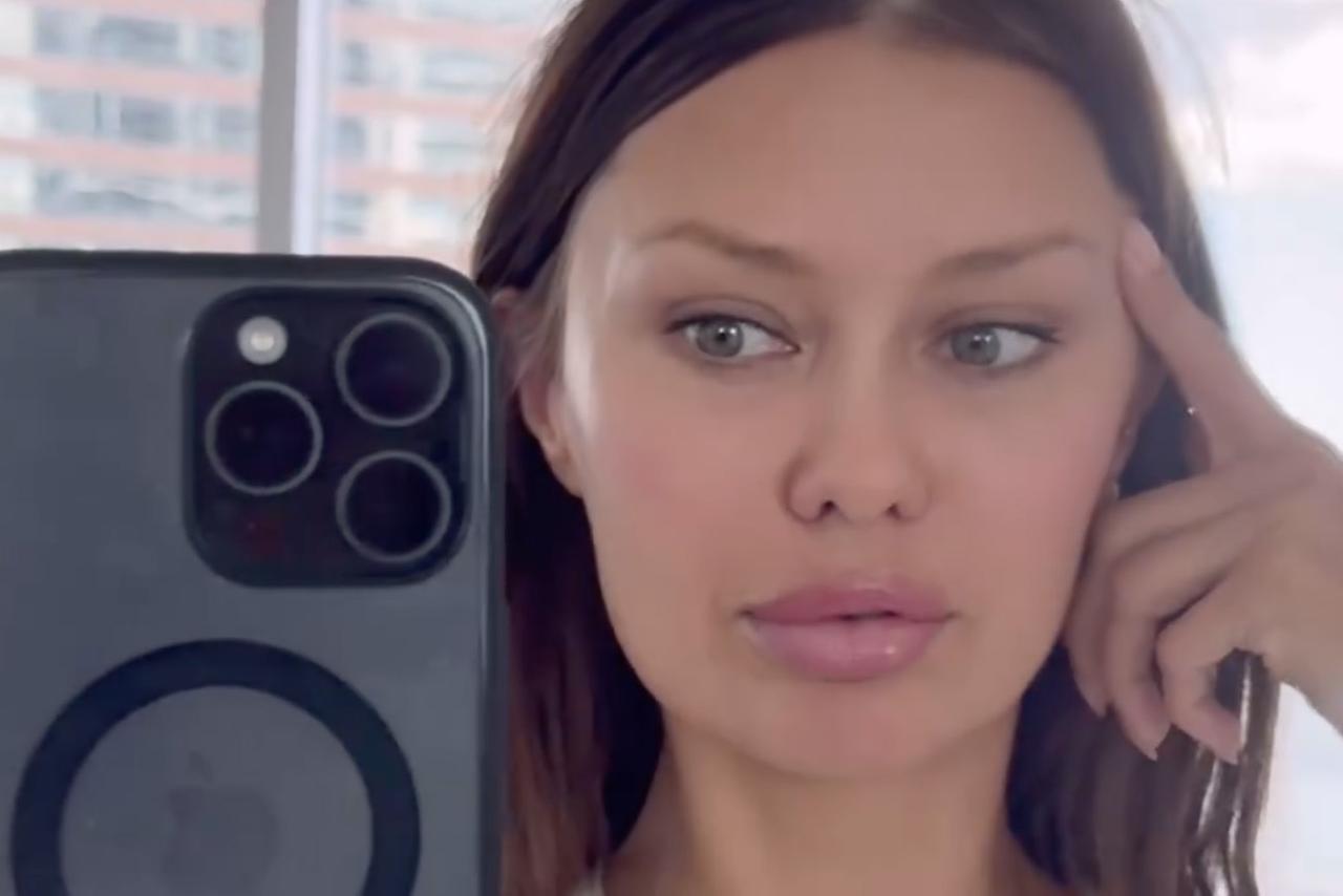 Виктория Боня захотела сделать еще одну пластическую операцию на лице