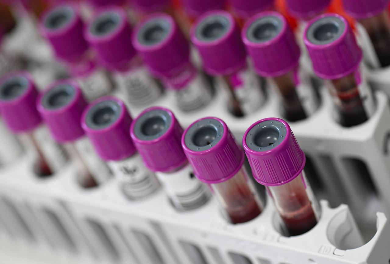 Доктор Мясников назвал основной показатель скрытого заболевания печени