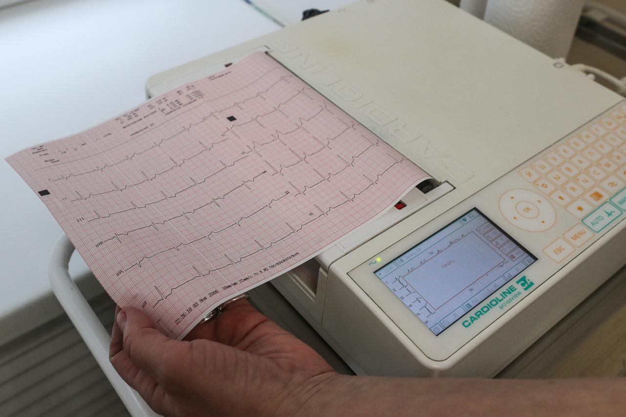 Кардиолог раскрыл неочевидные симптомы инфаркта