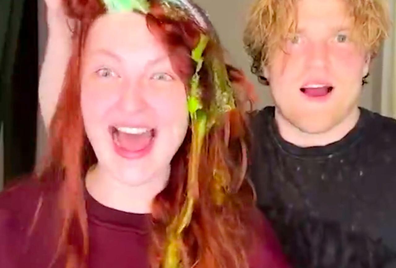 Российские подростки рискуют облысеть. Все дело в популярном интернет-тренде