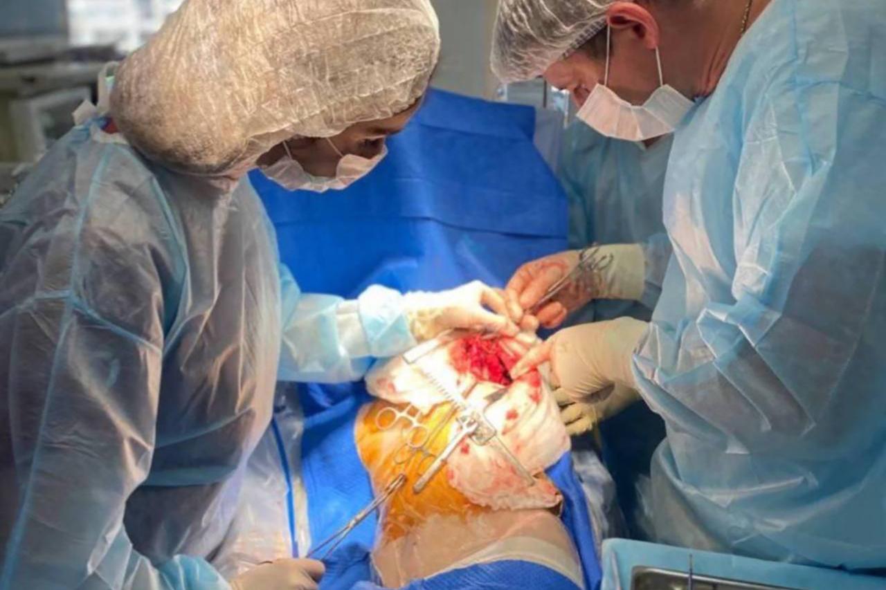 Москвичка поиграла с собакой и лишилась части легкого из-за паразитов