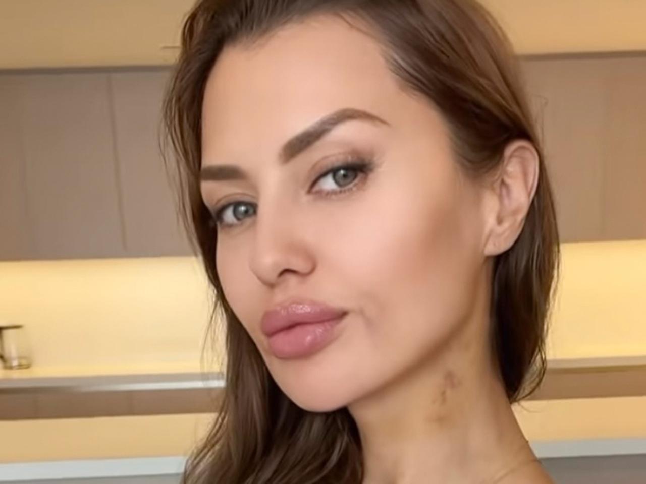 Боня операция до и после. Вика боня до пластики. Боня операция до и после. Вика боня до пластики. Вика боня до пластики.