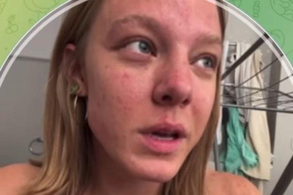 27-летняя звезда сериала «Чики» откровенно рассказала о проблемах с внешностью