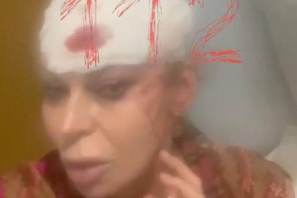 Опубликованы первые фото Лады Дэнс из больницы