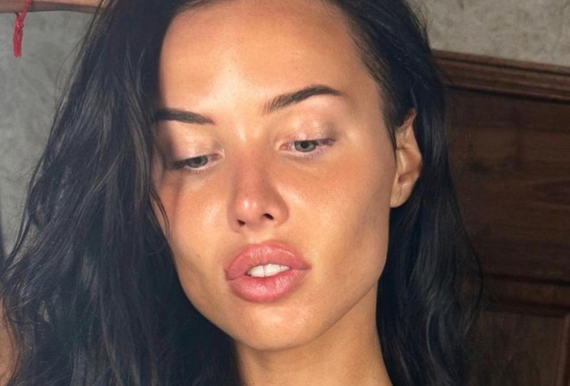 Анастасия Решетова показала лицо без косметики и фильтров