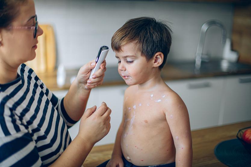 Родители стали специально заражать детей ветрянкой. Зачем они это делают?