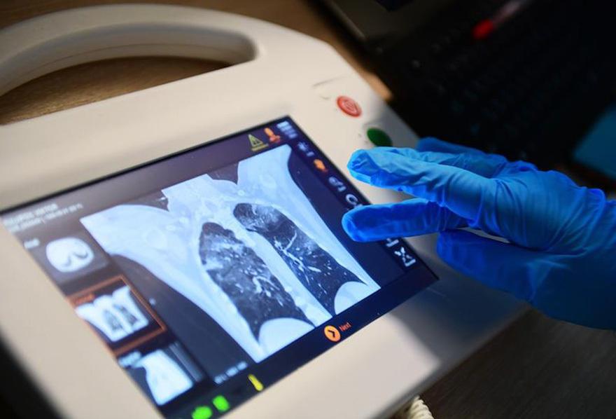 Доктор Мясников назвал провоцирующее развитие рака медицинское исследование